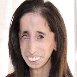 Lizzie Velasquez age